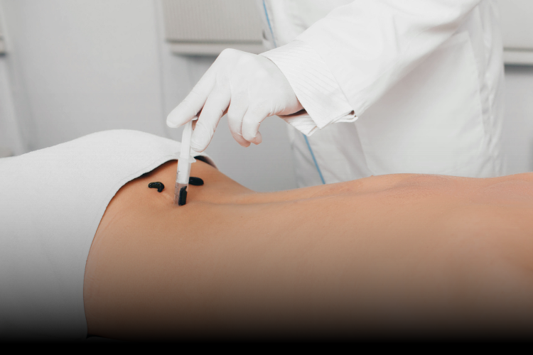 Hirudoterapia – jak to działa?